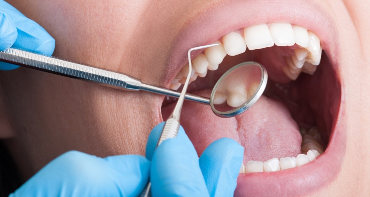 Teeth Cleaning Treatment